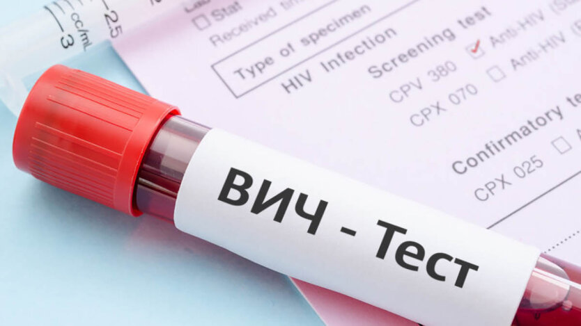 Rosja pogorszyła sytuację związana z HIV w Europie Wschodniej